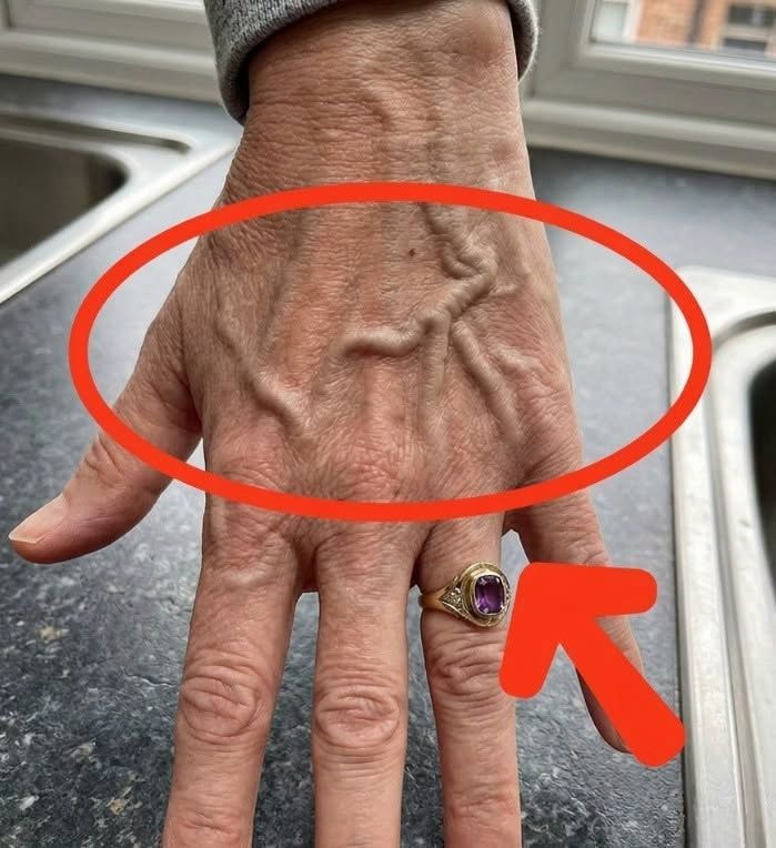 If you have visible veins, it means you are… See more 