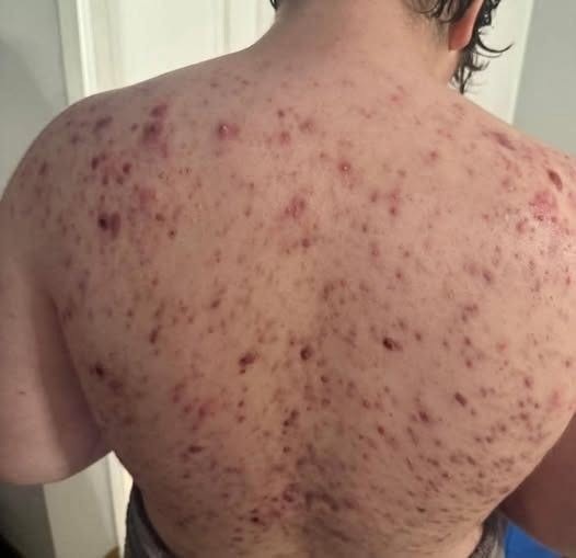 These are the consequences of sleeping with the…See more