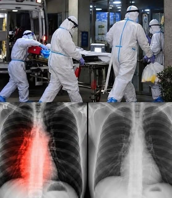Warning COVID​​​ vaccinated may be en​​​f… See more ​‍﻿͏ㅤ